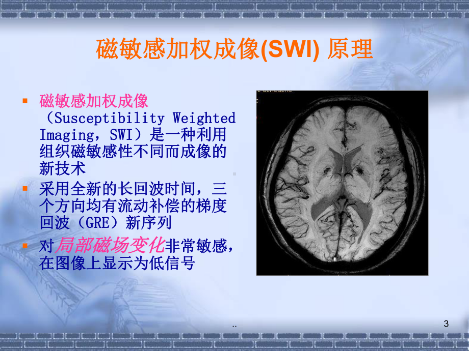 磁敏感加权成像(SWI)-原理及临床应用课课件.ppt_第3页