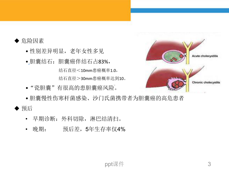 胆囊癌CT诊断-课件.ppt_第3页