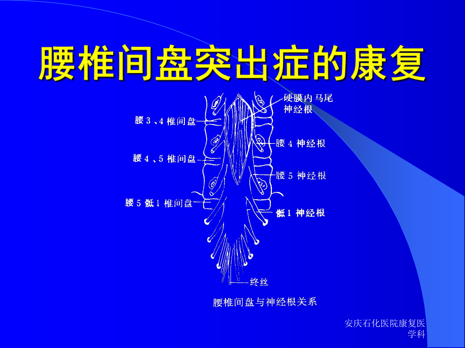 腰椎间盘突出症的康复课件-参考.ppt_第1页