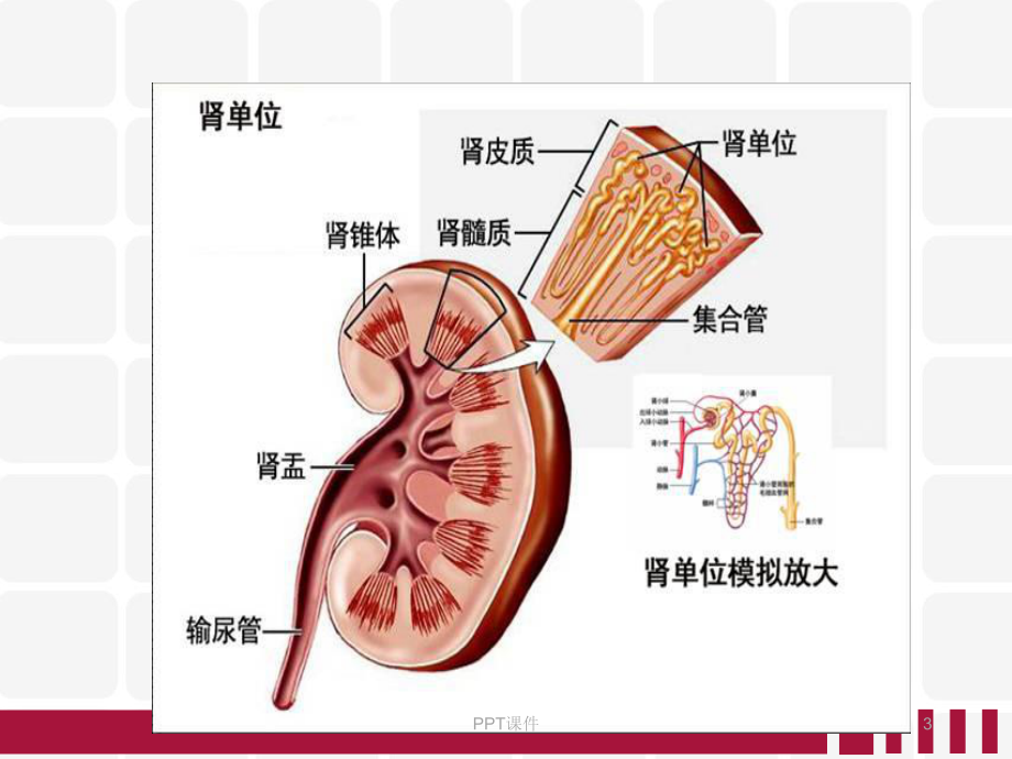 肾挫伤病人的护理查房-课件.ppt_第3页