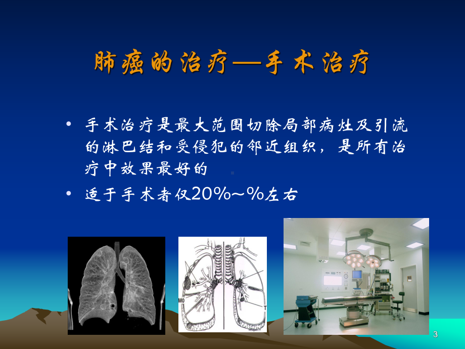 肺癌患者手术后康复指导课件.ppt_第3页