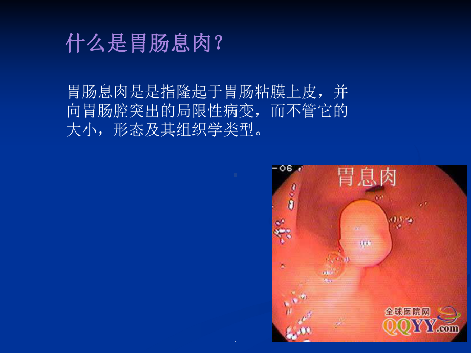 胃肠息肉课件(同名1599).ppt_第3页