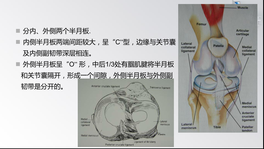 膝关节半月板损伤的磁共振表现课件.pptx_第2页