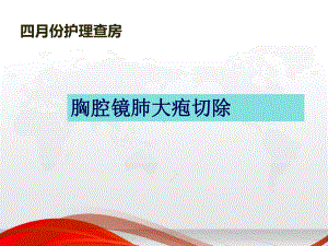 肺大疱护理查房-课件.ppt