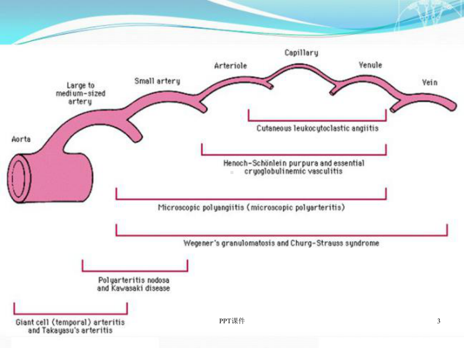 系统性血管炎诊断思路-课件.ppt_第3页