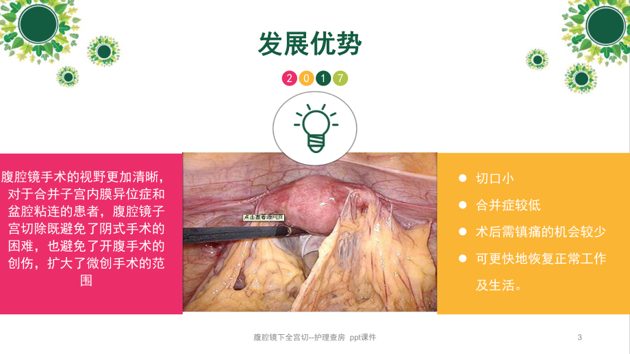 腹腔镜下全宫切护理查房-课件.ppt_第3页