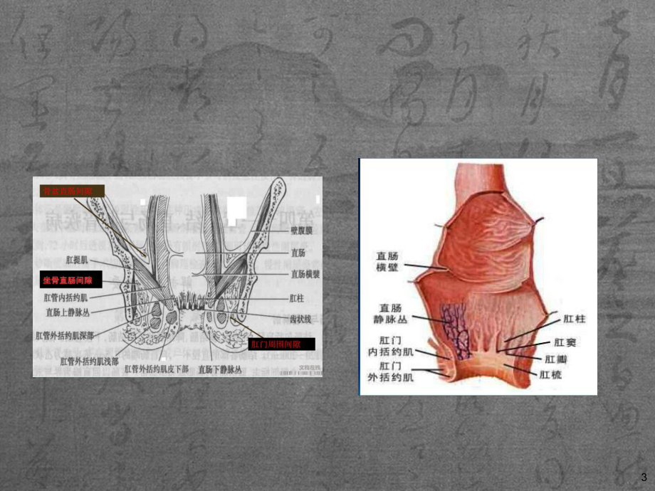 肛周疾病的护理-课件.ppt_第3页