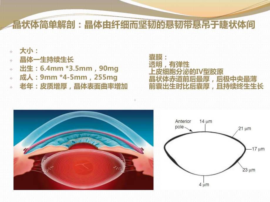 白内障手术基础-课件.ppt_第3页