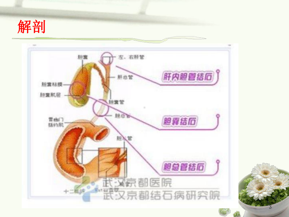 肝外胆管结石护理完整版本课件.ppt_第3页