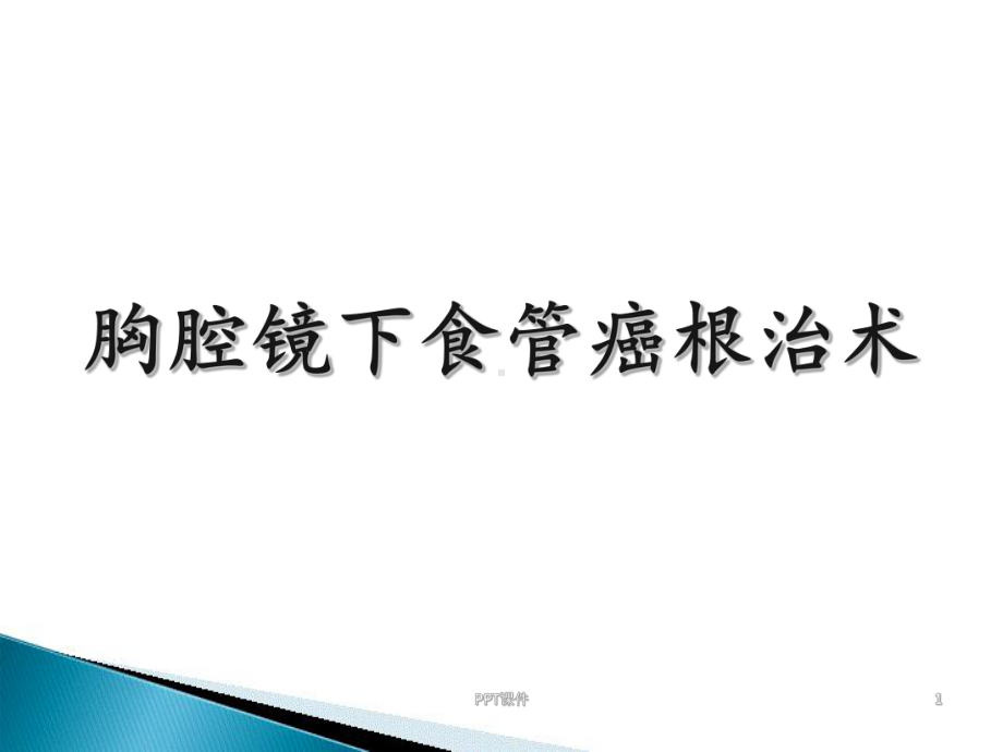 胸腔镜下食管癌根治术-课件.ppt_第1页