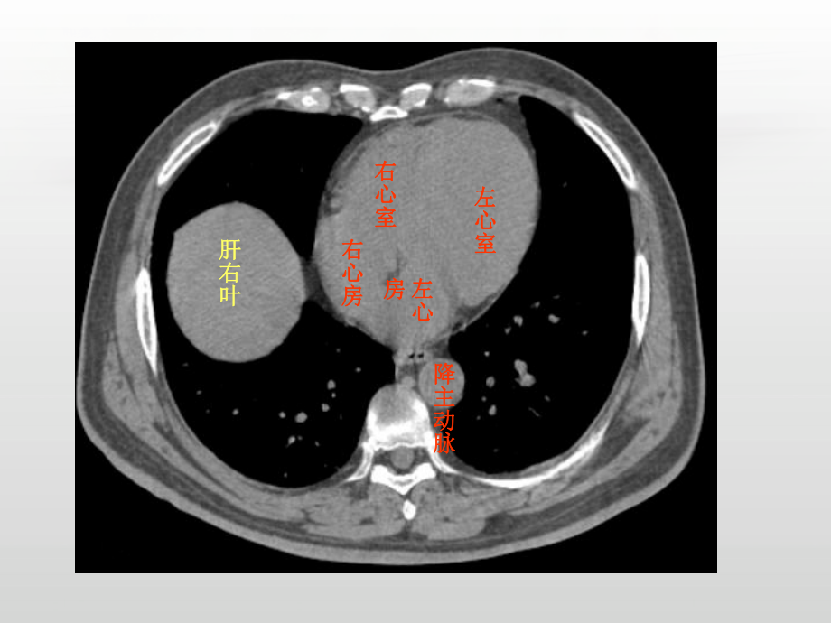 腹部影像解剖（放射科）-课件.ppt_第2页