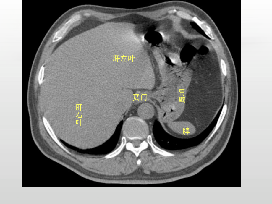 腹部影像解剖（放射科）-课件.ppt_第3页