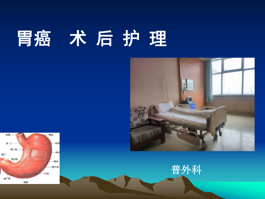 胃癌术后护理查房70558课件.ppt_第1页