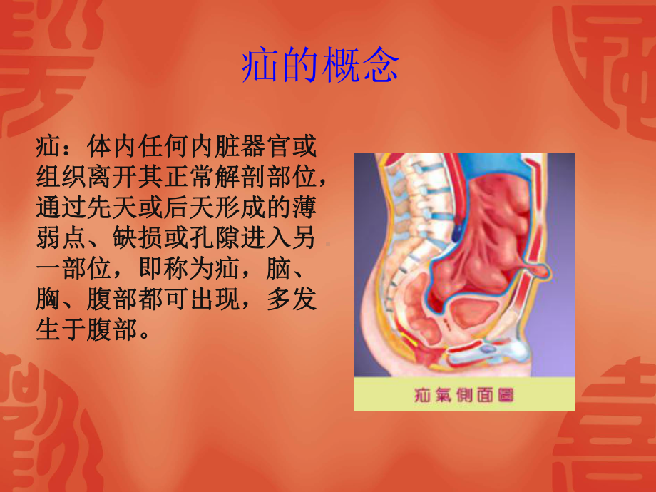 疝气讲座课件教学课件.ppt_第2页