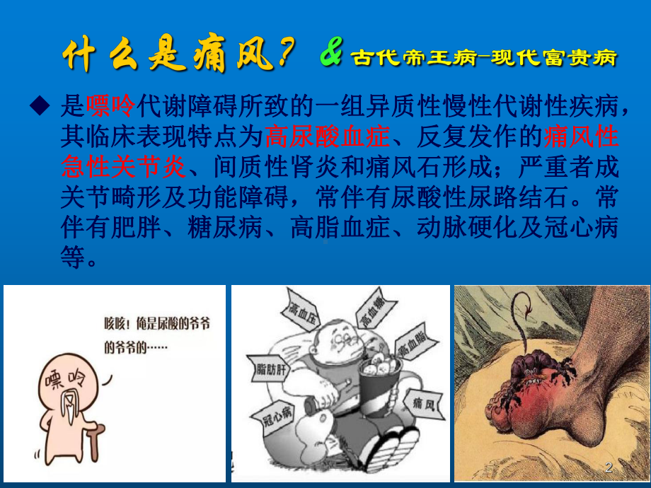 痛风科普课件.ppt_第2页