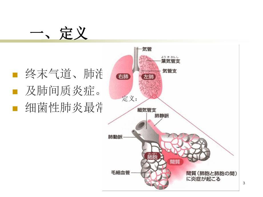 肺炎概述自己课件.ppt_第3页