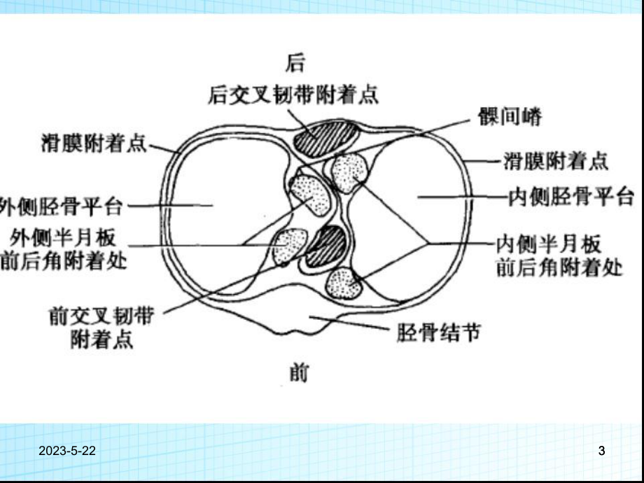 膝关节运动损伤课件.ppt_第3页