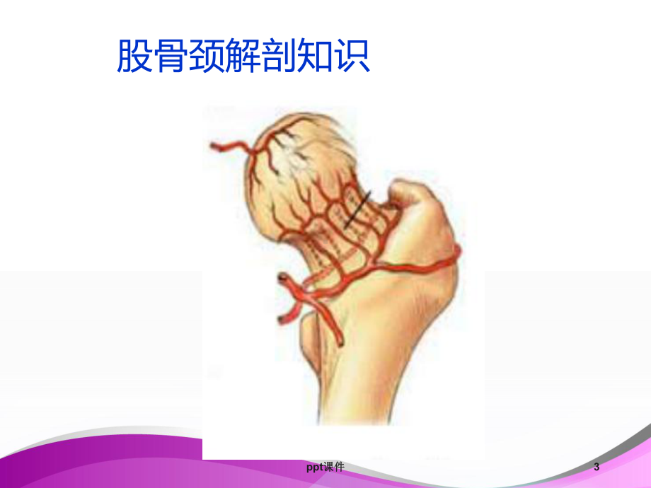 股骨颈骨折病人的护理-课件.ppt_第3页