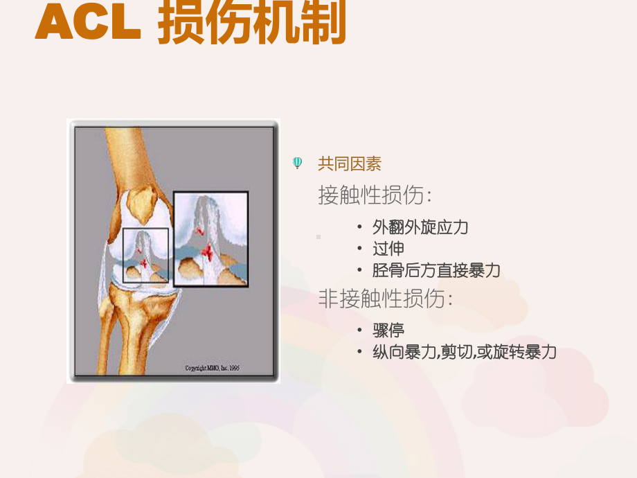 膝关节前交叉韧带损伤诊断与治疗-课件.ppt_第3页