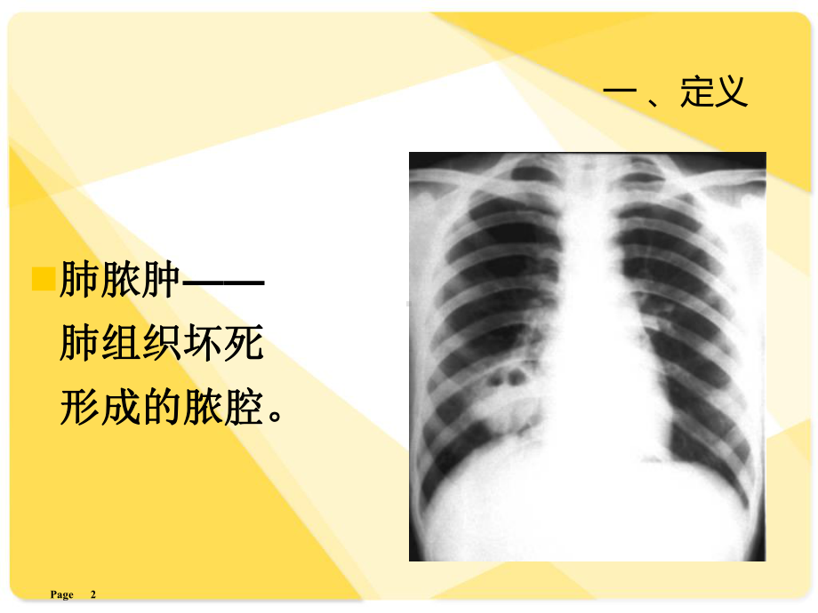 肺脓肿-教学讲解课件.ppt_第2页