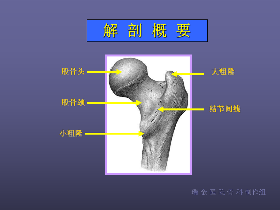 股骨颈骨折-课件-.ppt_第3页