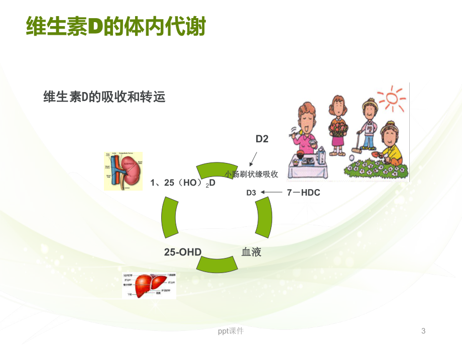 维生素D缺乏性佝偻病的护理-课件.ppt_第3页