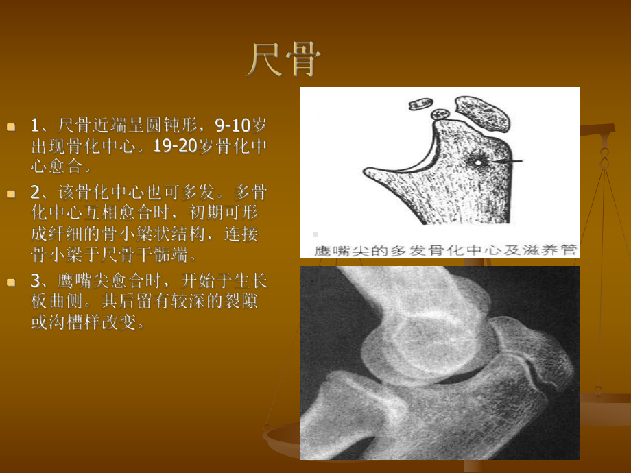 肘关节X线表现.ppt_第3页