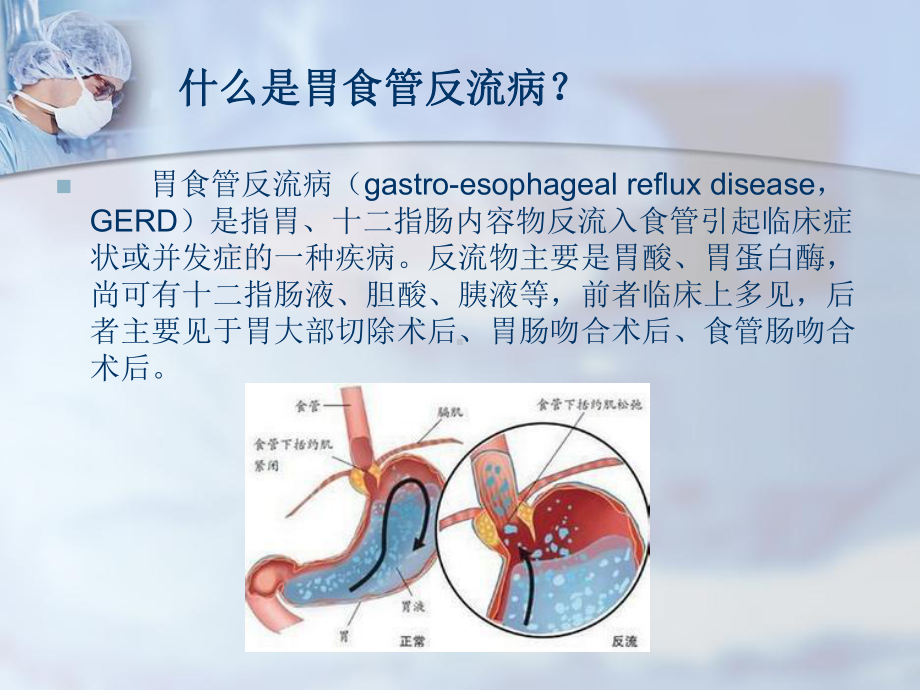 胃食管反流病健康教育课件(同名294).ppt_第2页