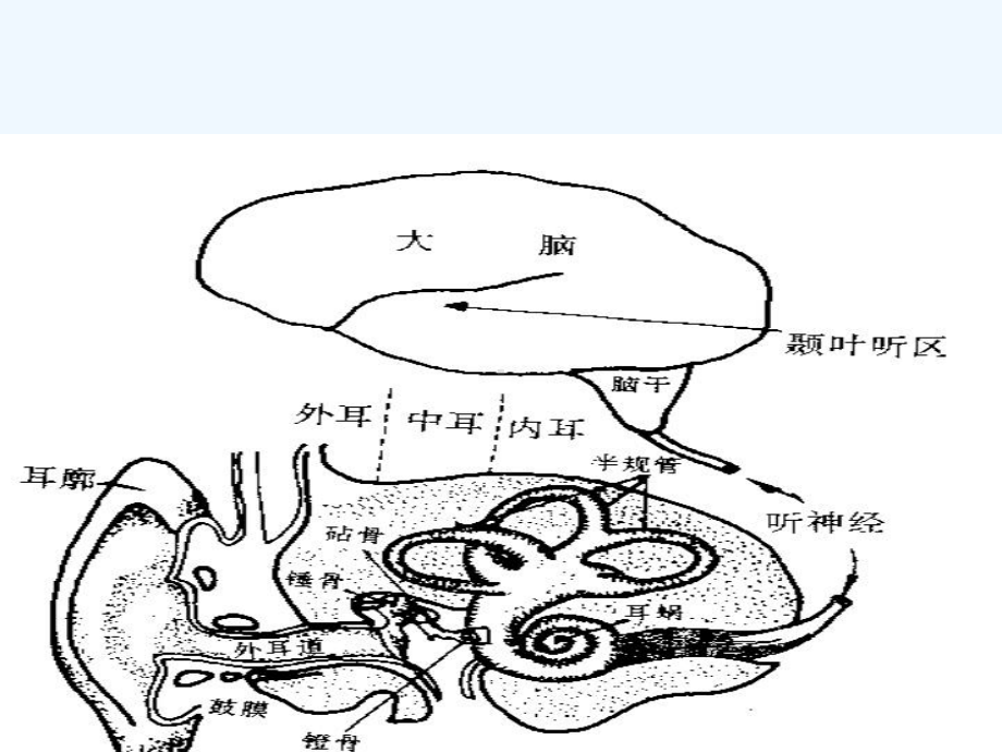 第三章-听觉障碍-课件.ppt_第3页