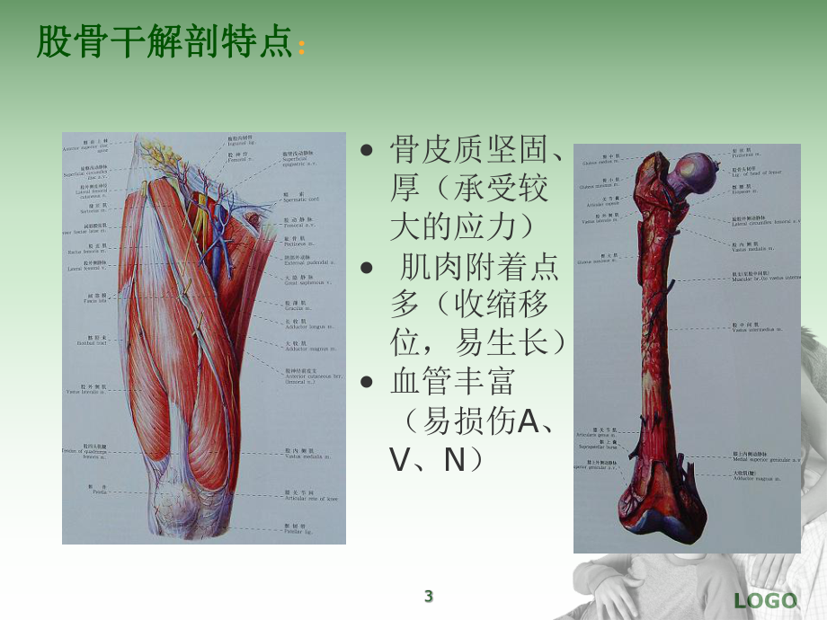 股骨干骨折的护理-课件.ppt_第3页