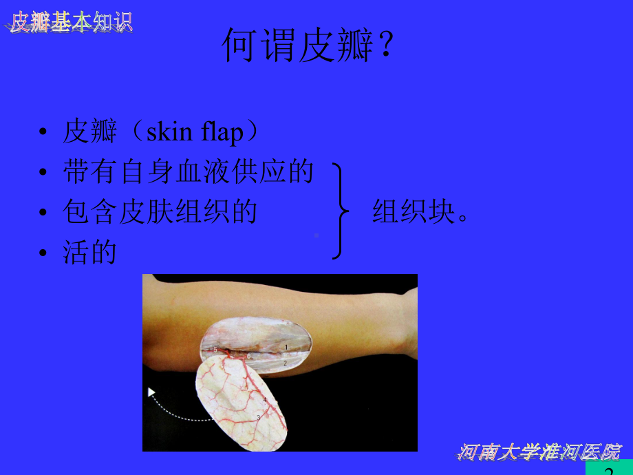 皮瓣的基本知识课件.ppt_第2页