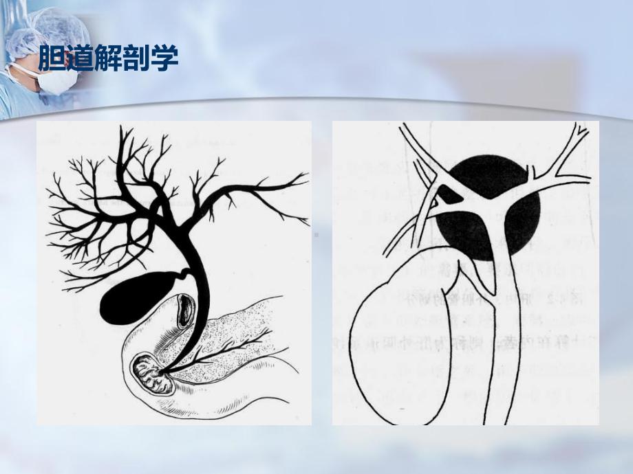 胆道支架-课件.ppt_第2页