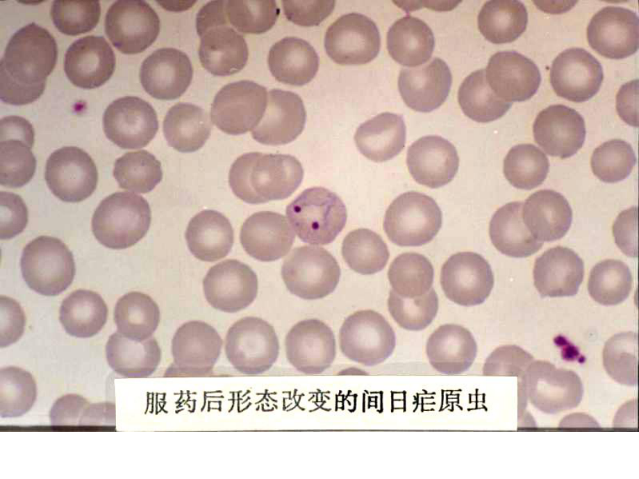 疟原虫形态照片--疟原虫图片教学课件.ppt_第2页