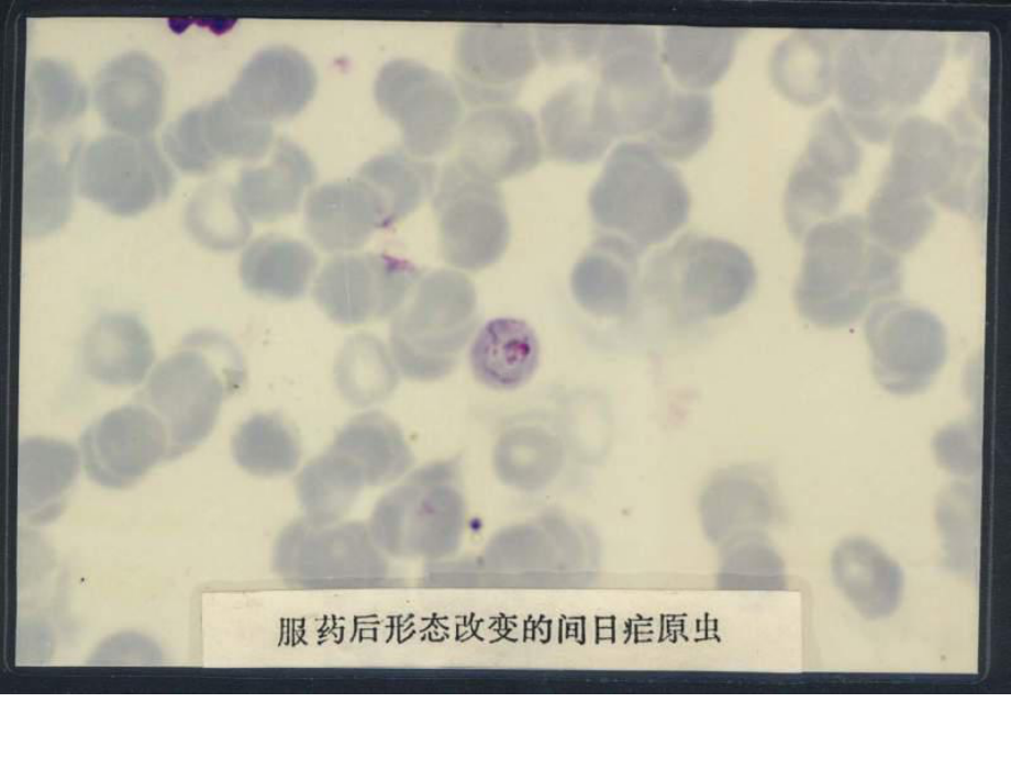 疟原虫形态照片--疟原虫图片教学课件.ppt_第3页