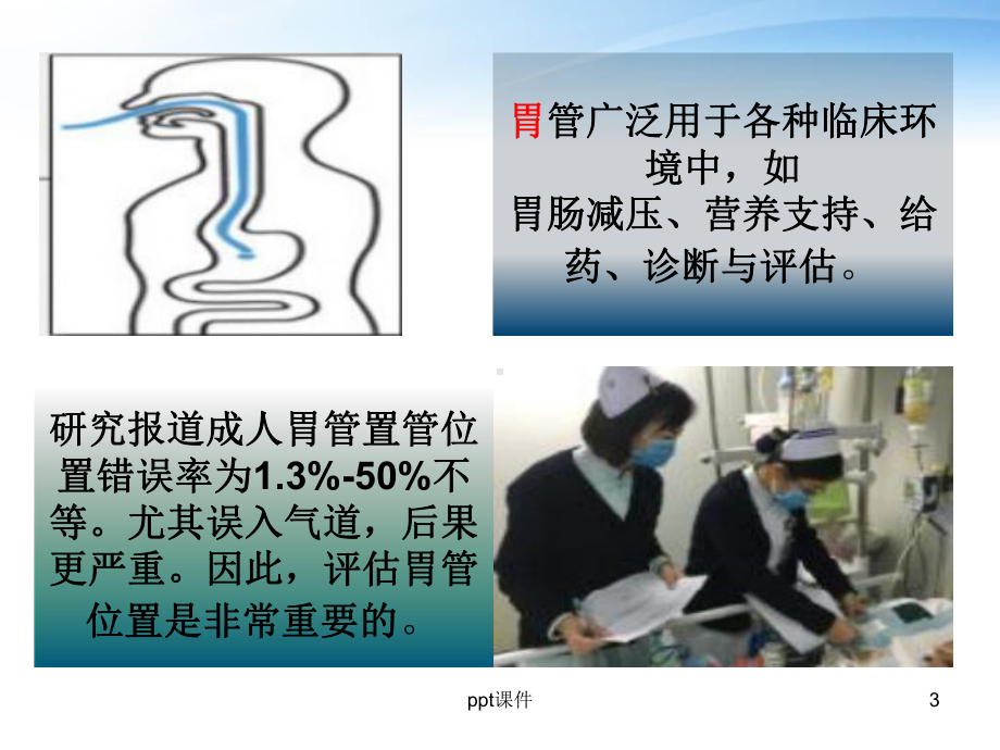 胃肠管位置判断及常见方法及误区-课件.ppt_第3页