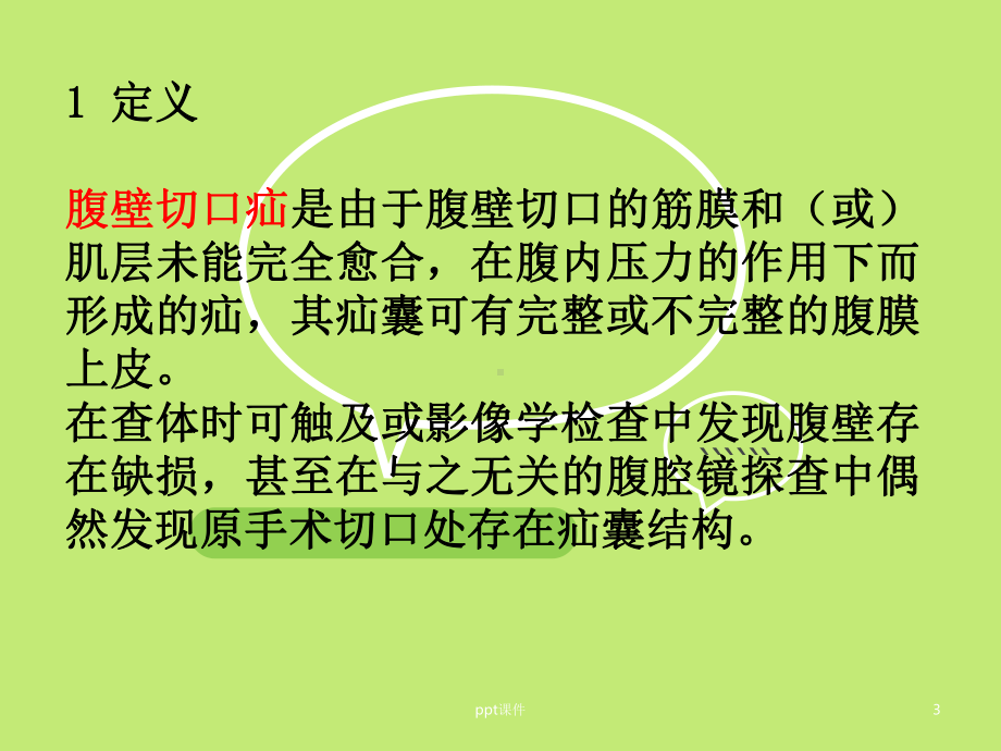 腹壁切口疝诊疗指南-课件.ppt_第3页