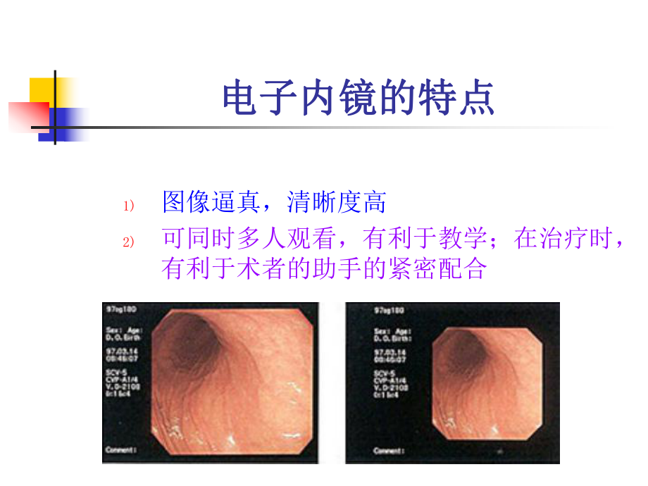 结肠镜医学课件.ppt_第3页