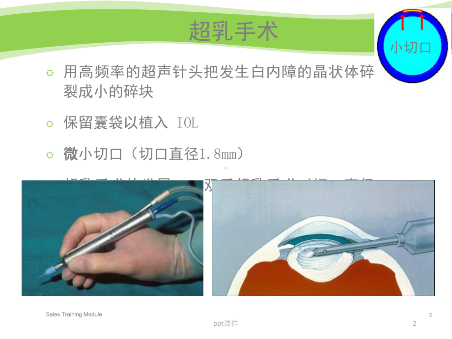 白内障手术过程及并发症-课件.ppt_第2页