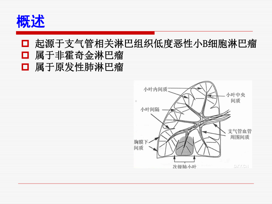 肺MALT淋巴瘤课件.pptx_第3页