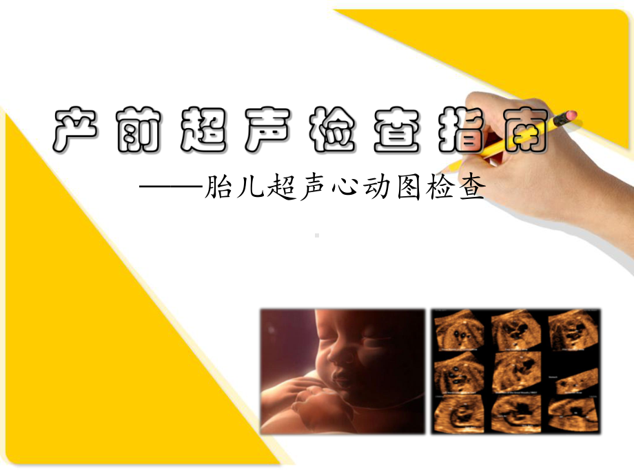 胎儿心脏检查规范课件.ppt_第1页