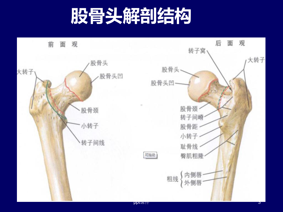 股骨头坏死简介-课件.ppt_第3页