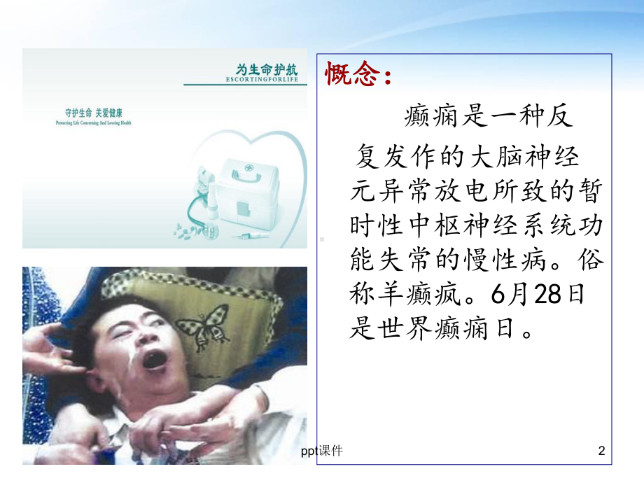 癫痫的表现及急救处理-课件.ppt_第2页