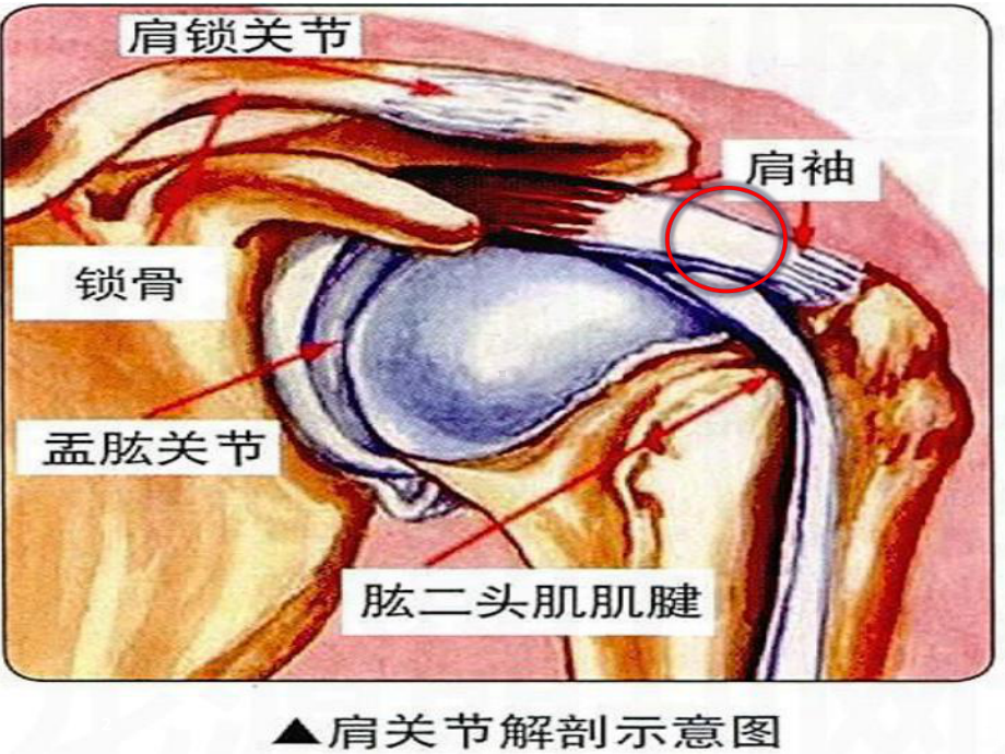 肩袖损伤护理课件(同名773).ppt_第2页