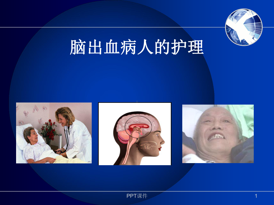 脑出血病人的护理-课件.ppt_第1页