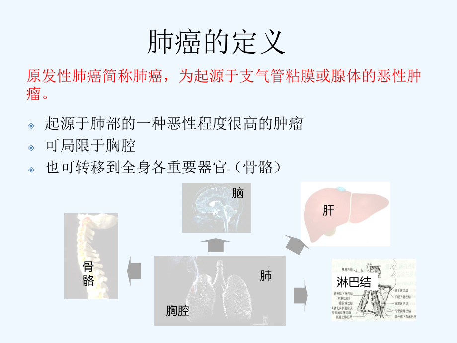 肺癌临床基础知识与治疗方案.pptx_第2页