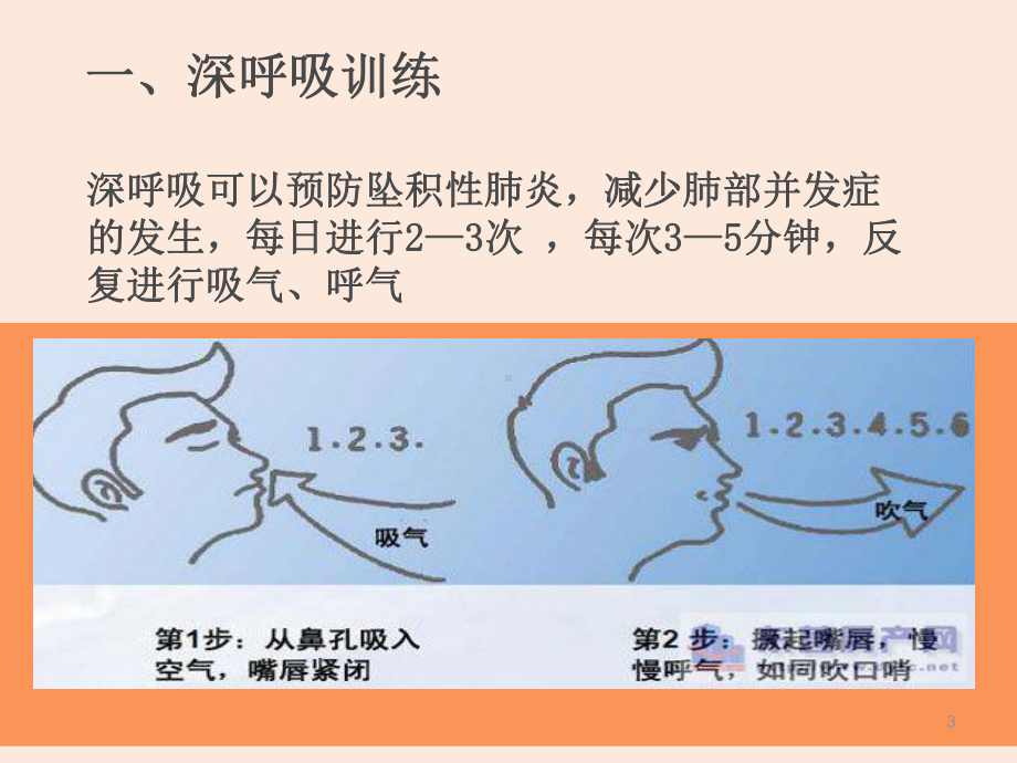 腰椎间盘突出症的术前宣教课件.ppt_第3页