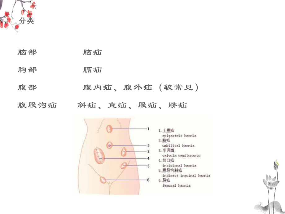 疝气讲课课件.ppt_第3页