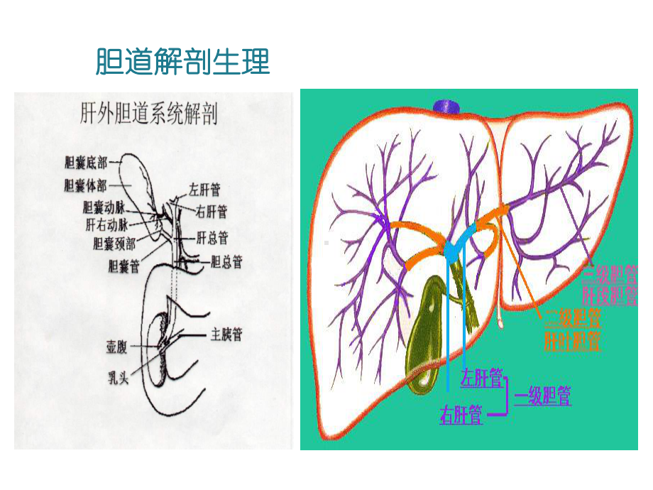 胆囊结石诊疗现状-课件.ppt_第2页