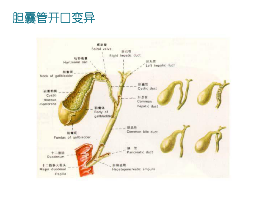 胆囊结石诊疗现状-课件.ppt_第3页