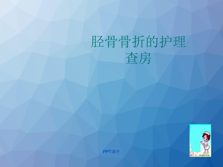 胫骨骨折的护理查房-课件.ppt_第1页